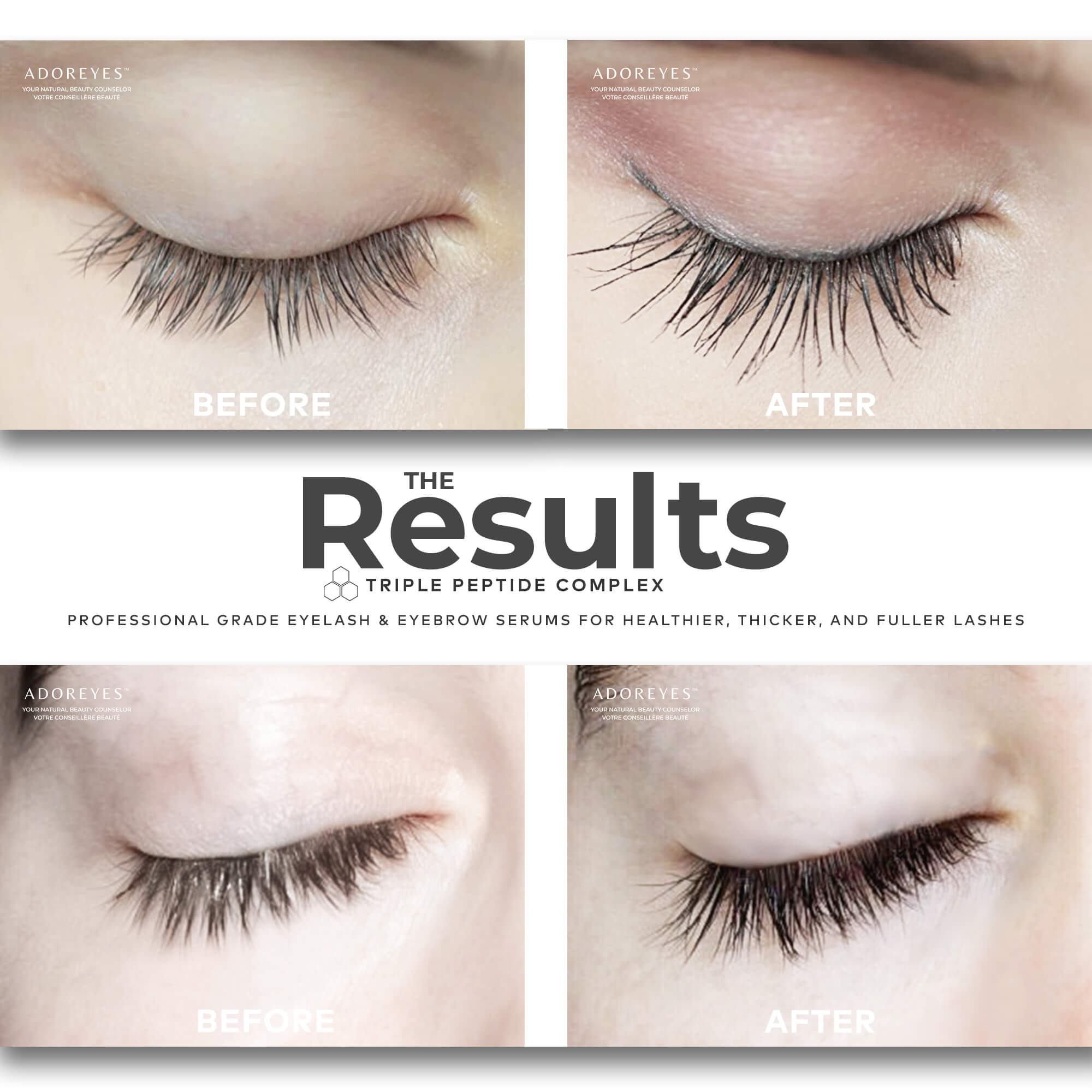 ADOREYES Before & After Ad Copy XX