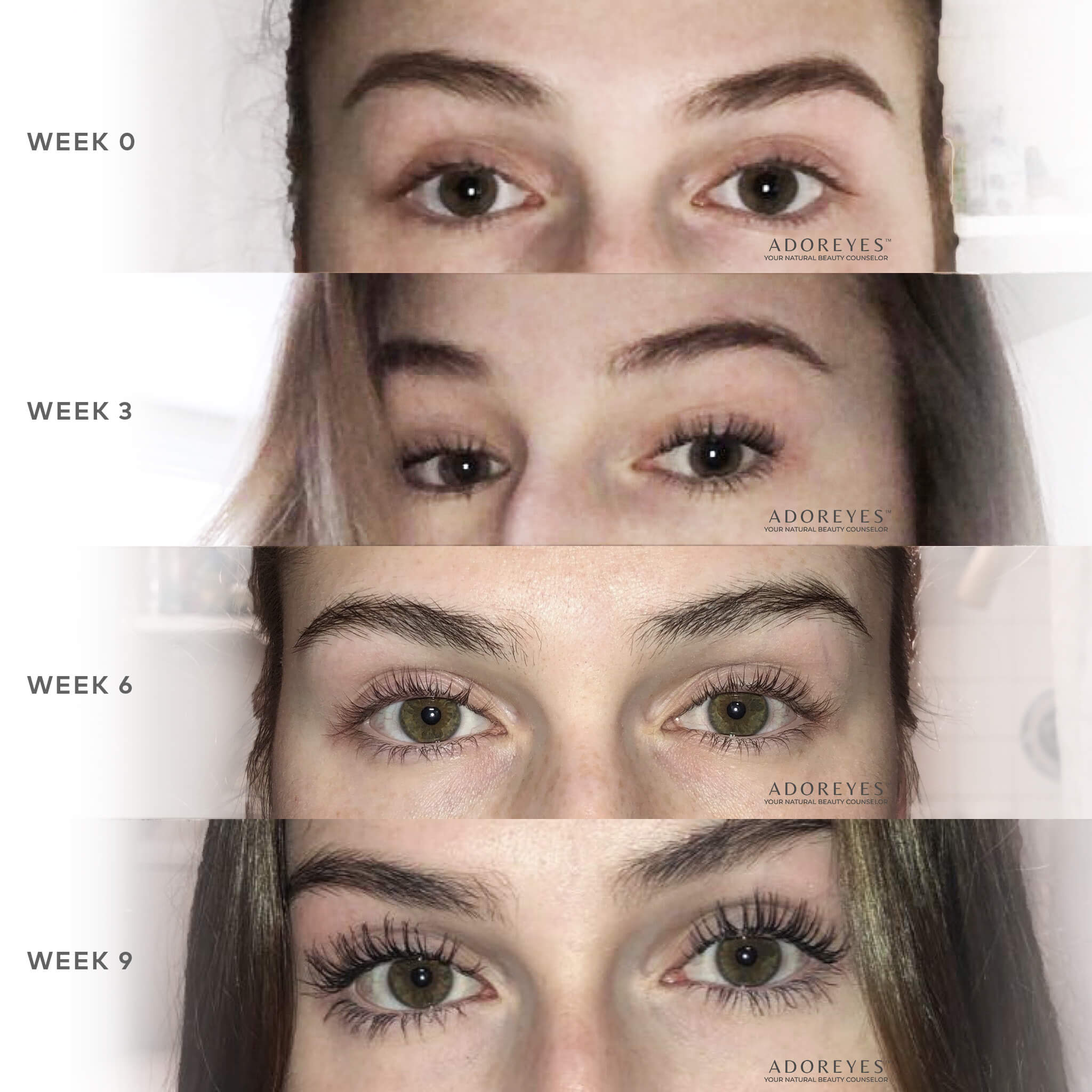 ADOREYES Before & After Natalia 0-9 Weeks XXX